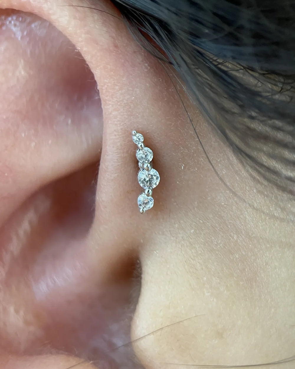 Forward helix