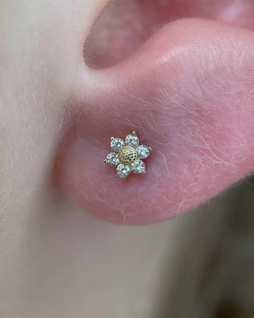 Lobe