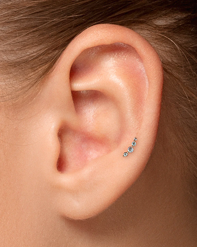 Upper Lobe